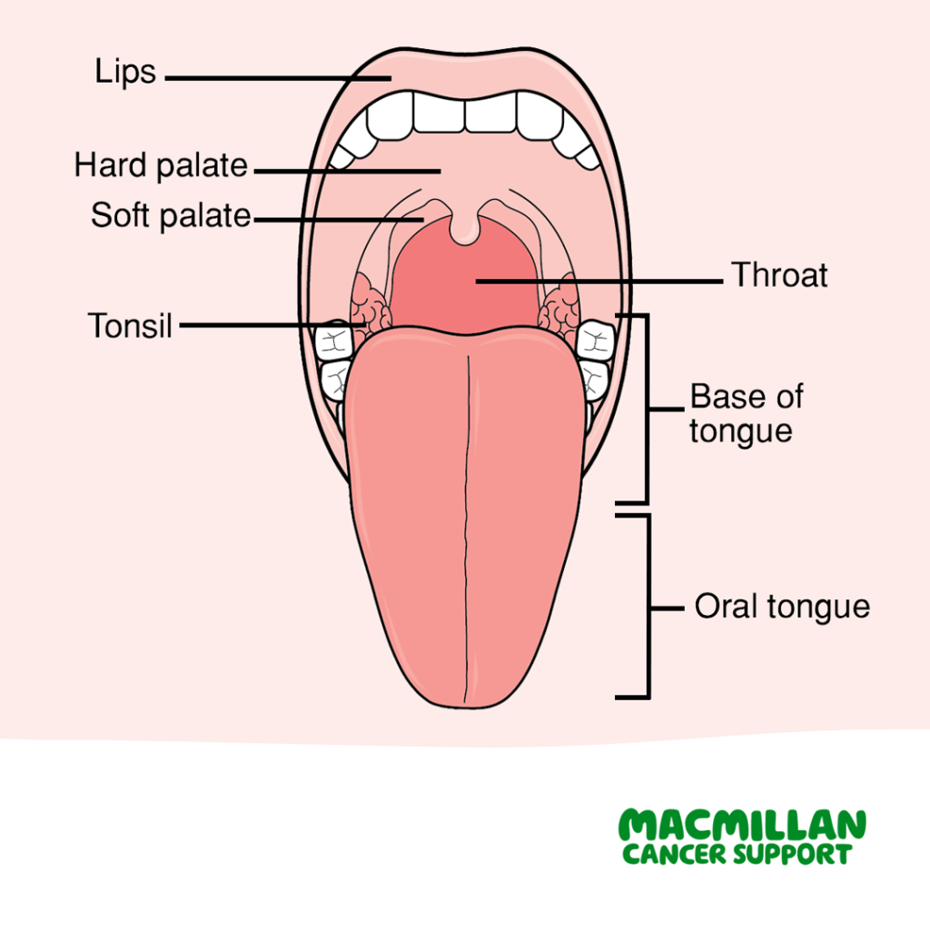 Mouth Cancer Symptoms | The Vallance Dental Centre